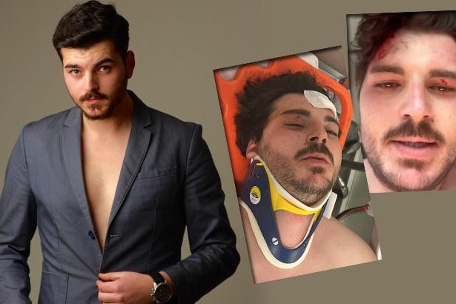 Otoyolda Kamyon ve Otomobil Çarpışması: Yaralanan Ünlü Oyuncu Mehmet Akif Akdeniz