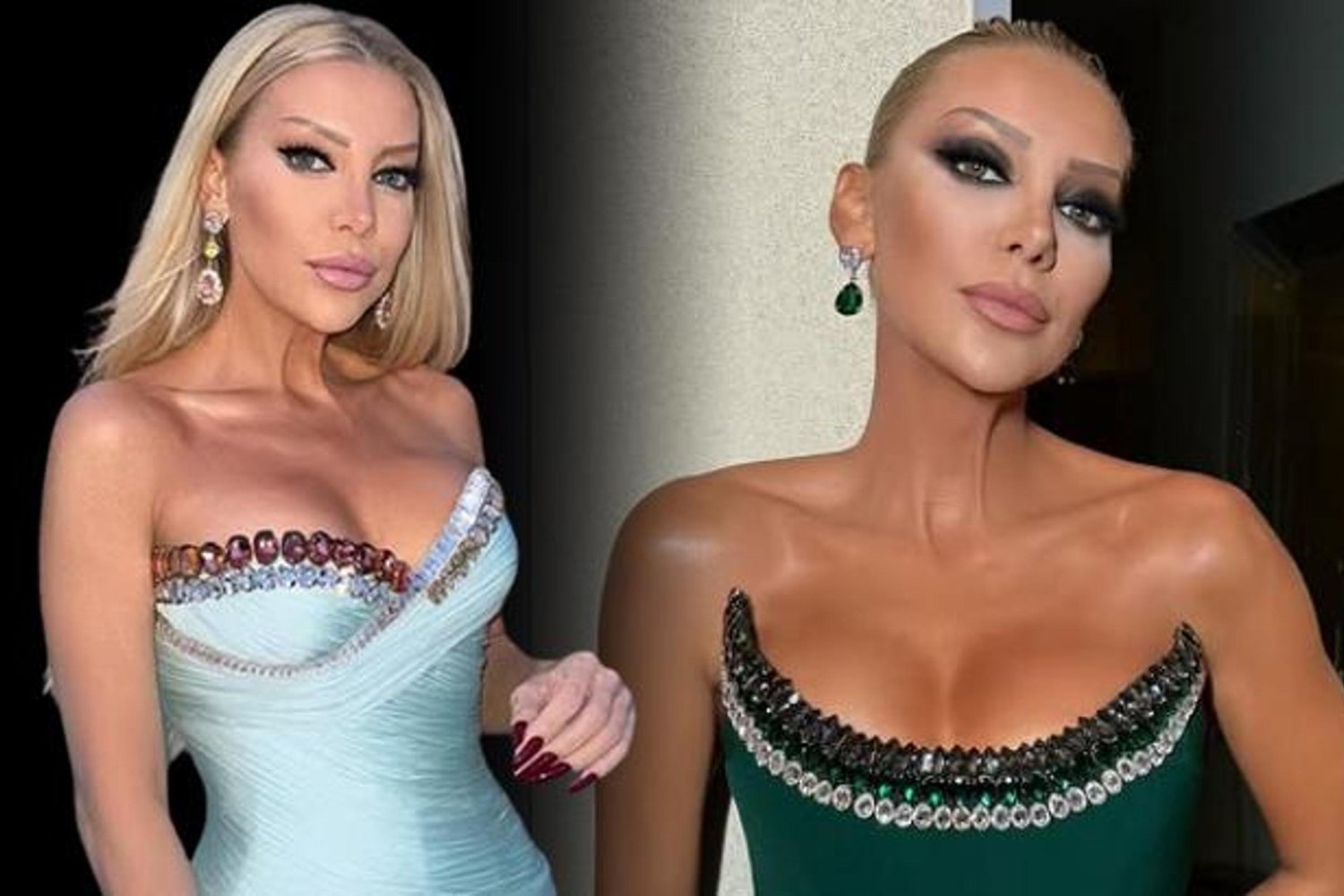 Moda Dünyasının Ünlü Modacısı Gülşah Saraçoğlu Estetik Operasyonu ve Son Durumu