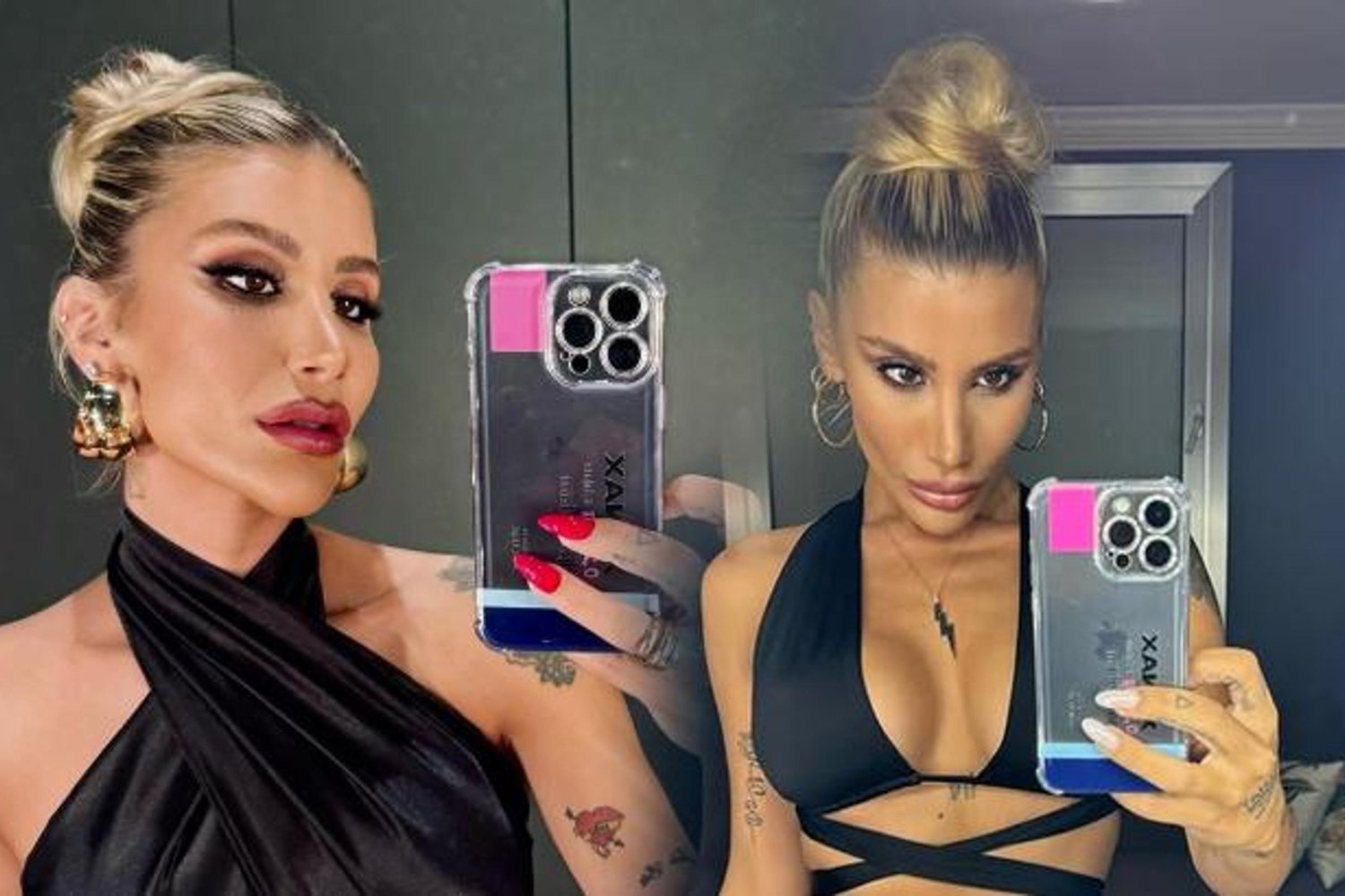 İrem Derici Estetik İtirafı: Gerçekleri Öğrenin!