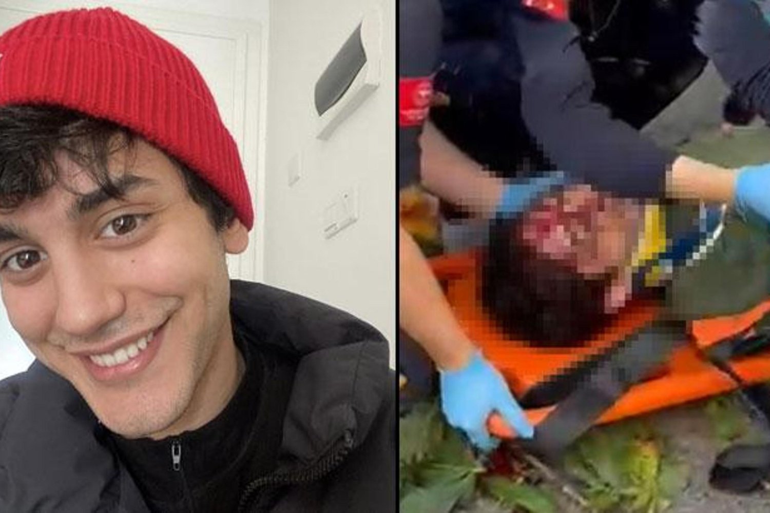 Korkutan Olay: Rüzgarın Devirdiği Ağaç Çocuk Oyuncuyu Ağır Yaraladı