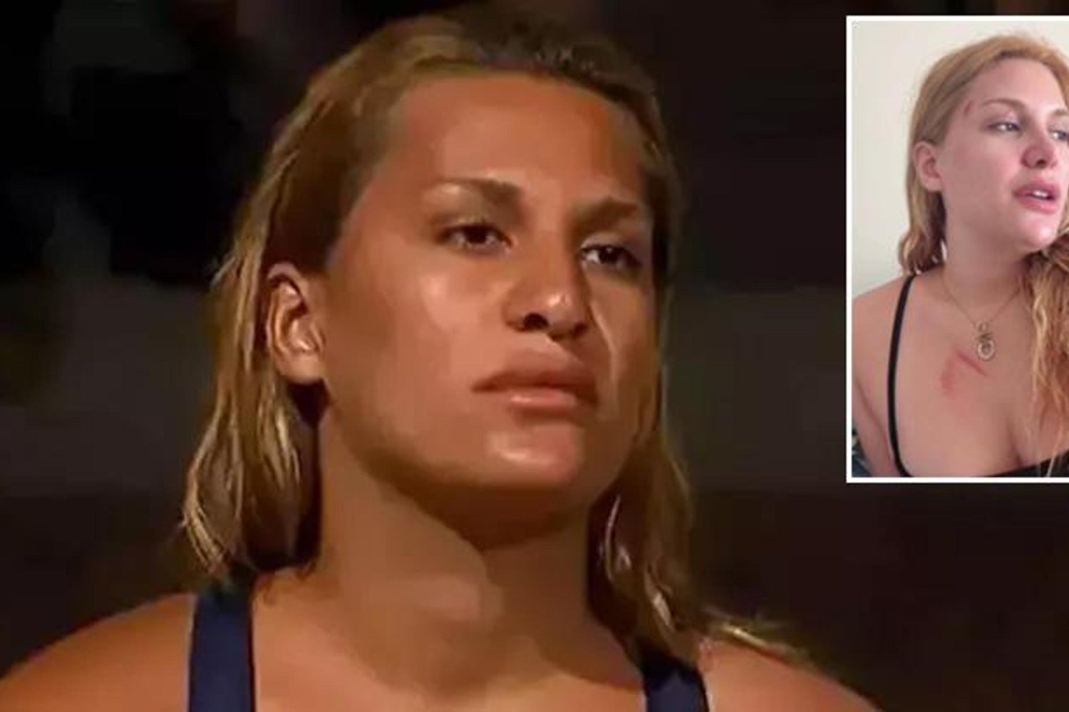 Şok Haber: Survivor Almeda Baylan Kaza Yaptığını Duyurdu!