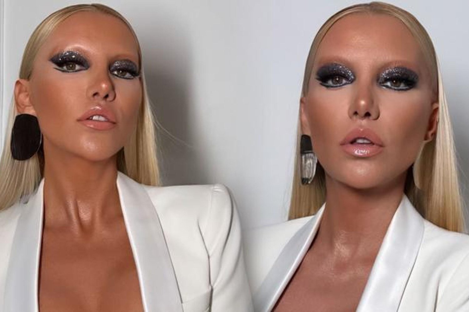 Modacı Gülşah Saraçoğlu Estetik Operasyonlarıyla Yeniden Sahneye Çıktı