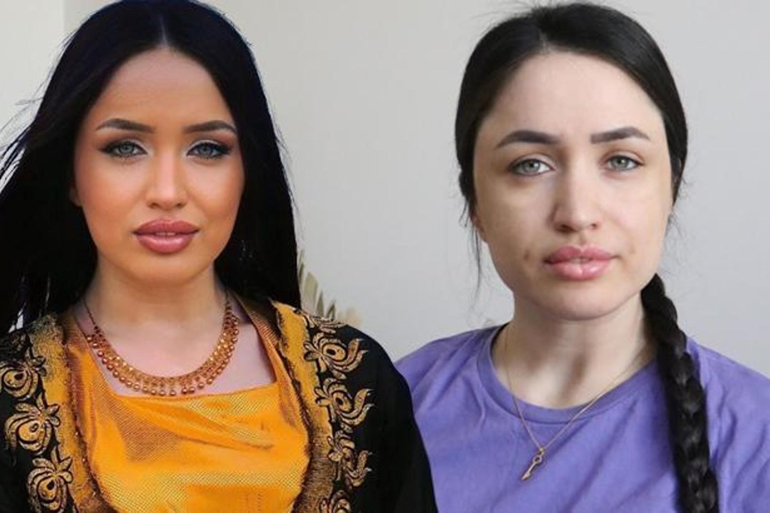 Diyarbakır'da 10 Yıllık Mücadeleyle Yürüme Gücüne Kavuşan Mutlu Kaya