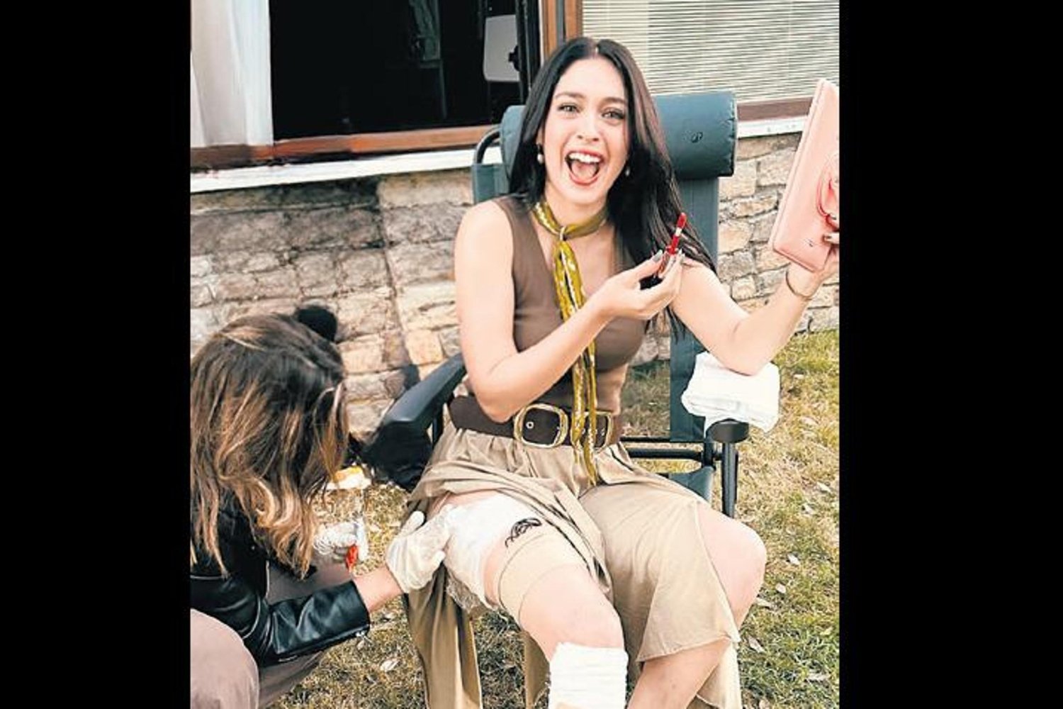 Oyuncu Sette Düştü! Yara İzlerini Paylaştı, Hayranlarından Geçmiş Olsun Mesajları Yağdı