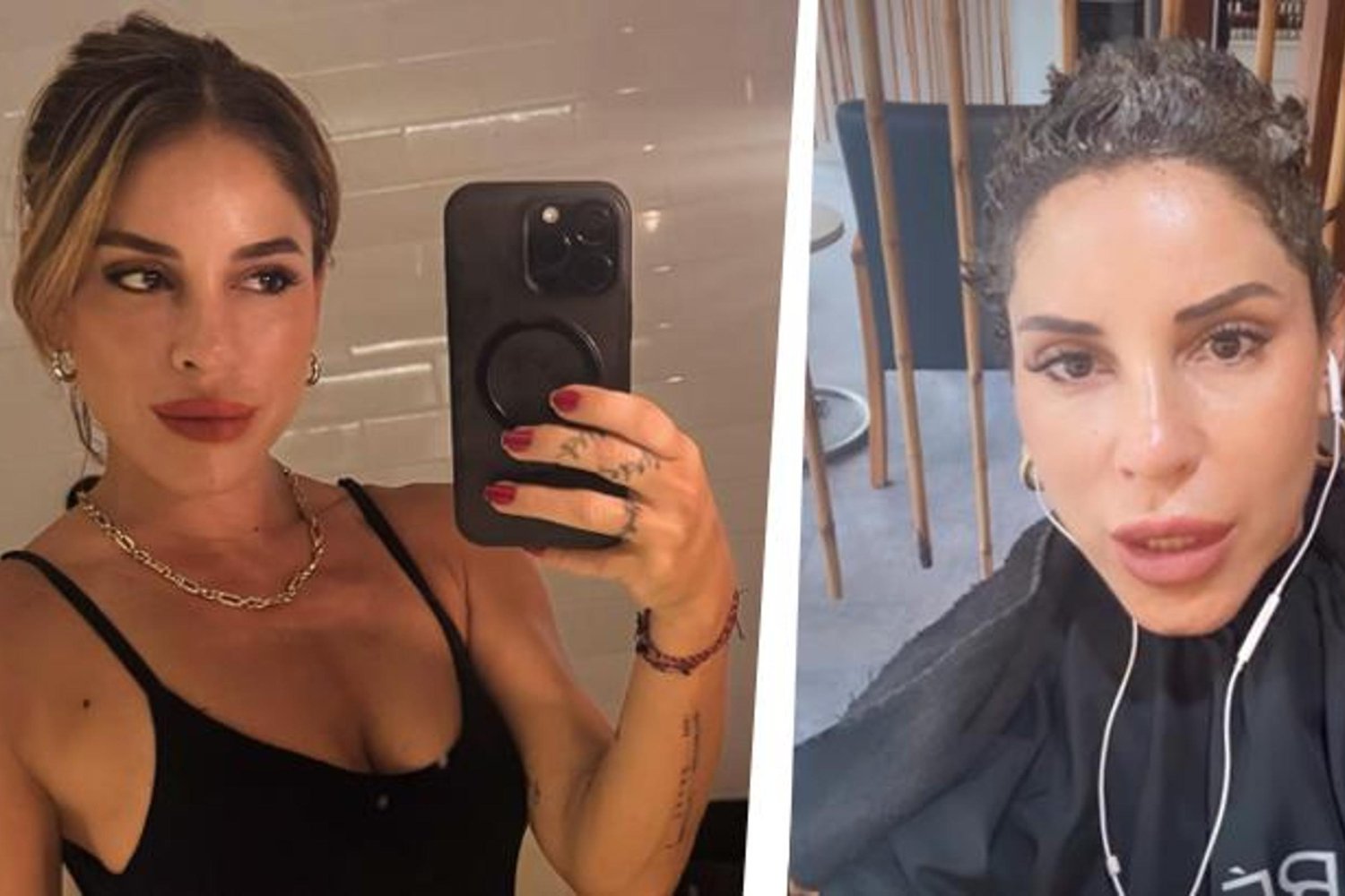 Irmak Ünal’dan Meme Kanseri Mücadelesi ve Saç Uzatma Paylaşımı