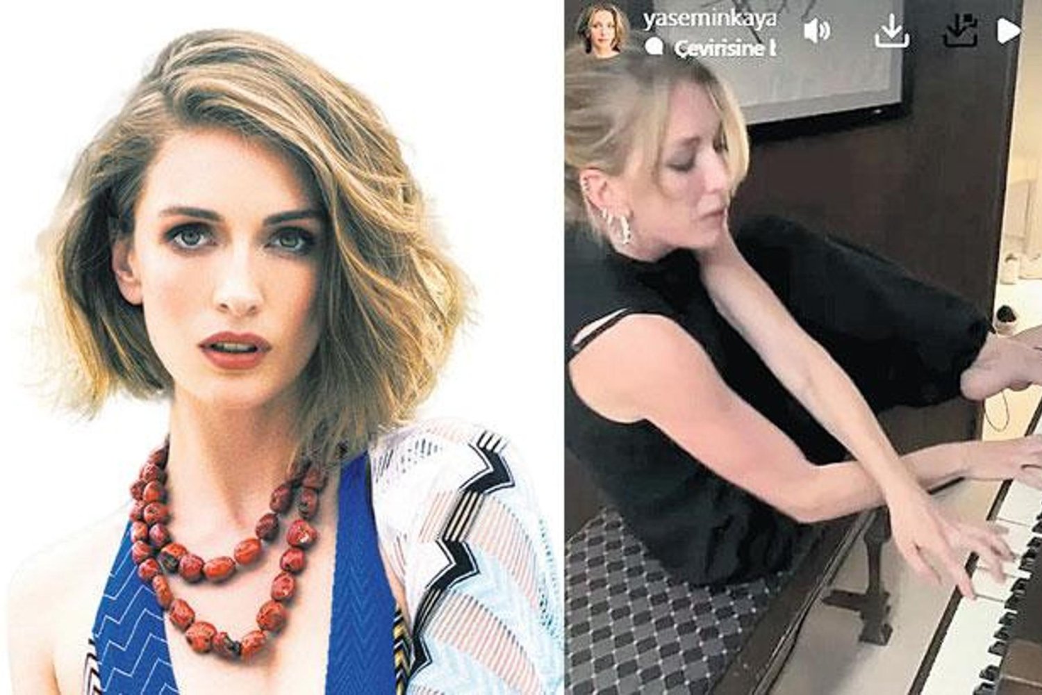 Hayranlardan Destek Yağdı! Allen'in Eller ve Ayaklarla Piyano Çalma Performansı