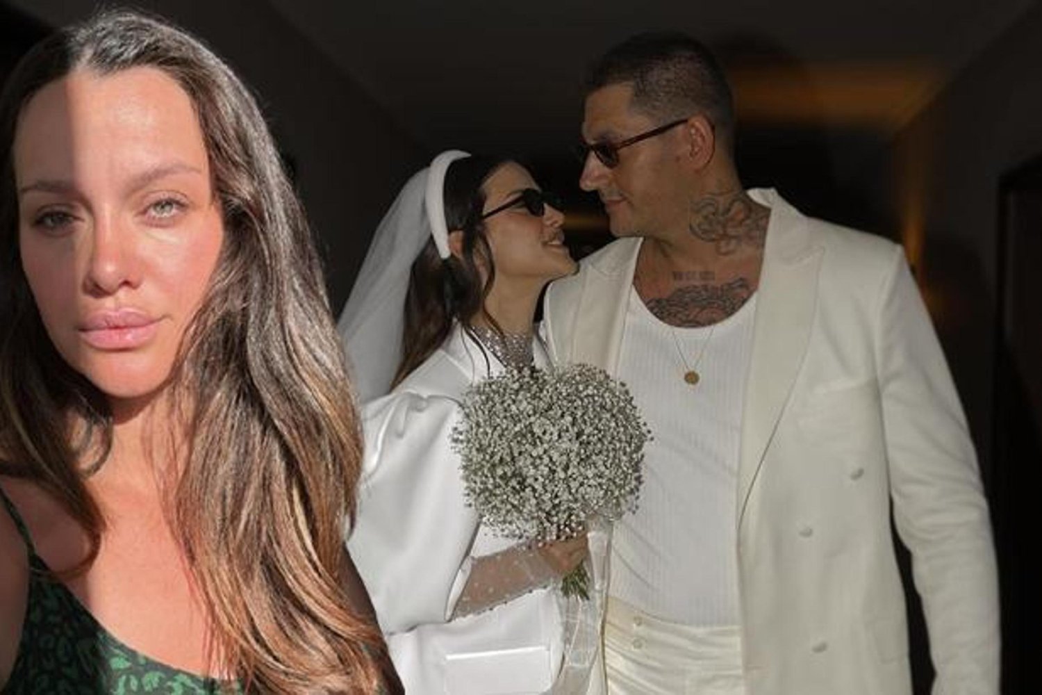 İrem Helvacıoğlu Kaza Geçirdi: Motor Çarpmasıyla Yaralandı!