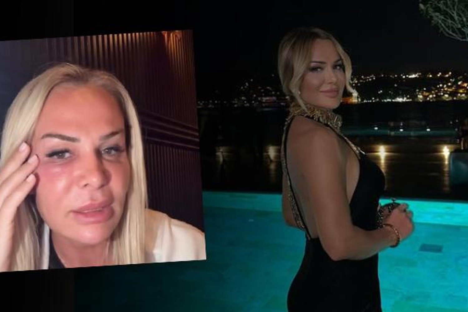 Nagihan Karadere Yüzünün Şişliğiyle Güvenlik Endişelerini Gündeme Getirdi