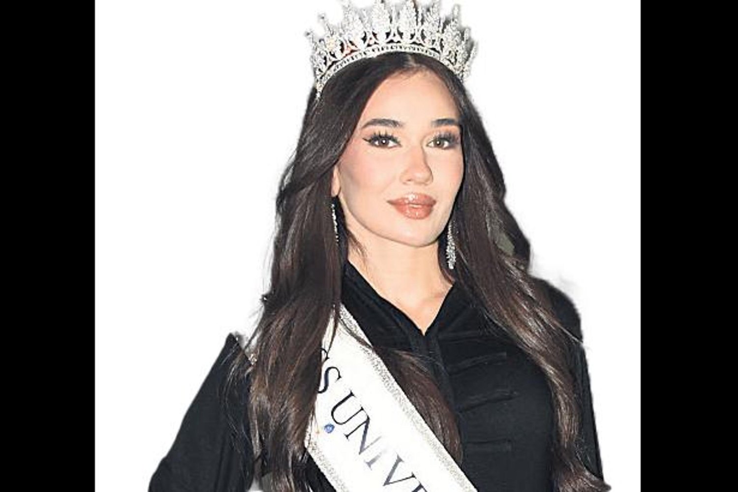 Modellik Yarışmasında İnişli Çıkışlar: Arslan’ın İtirafları ve Güncel Durum