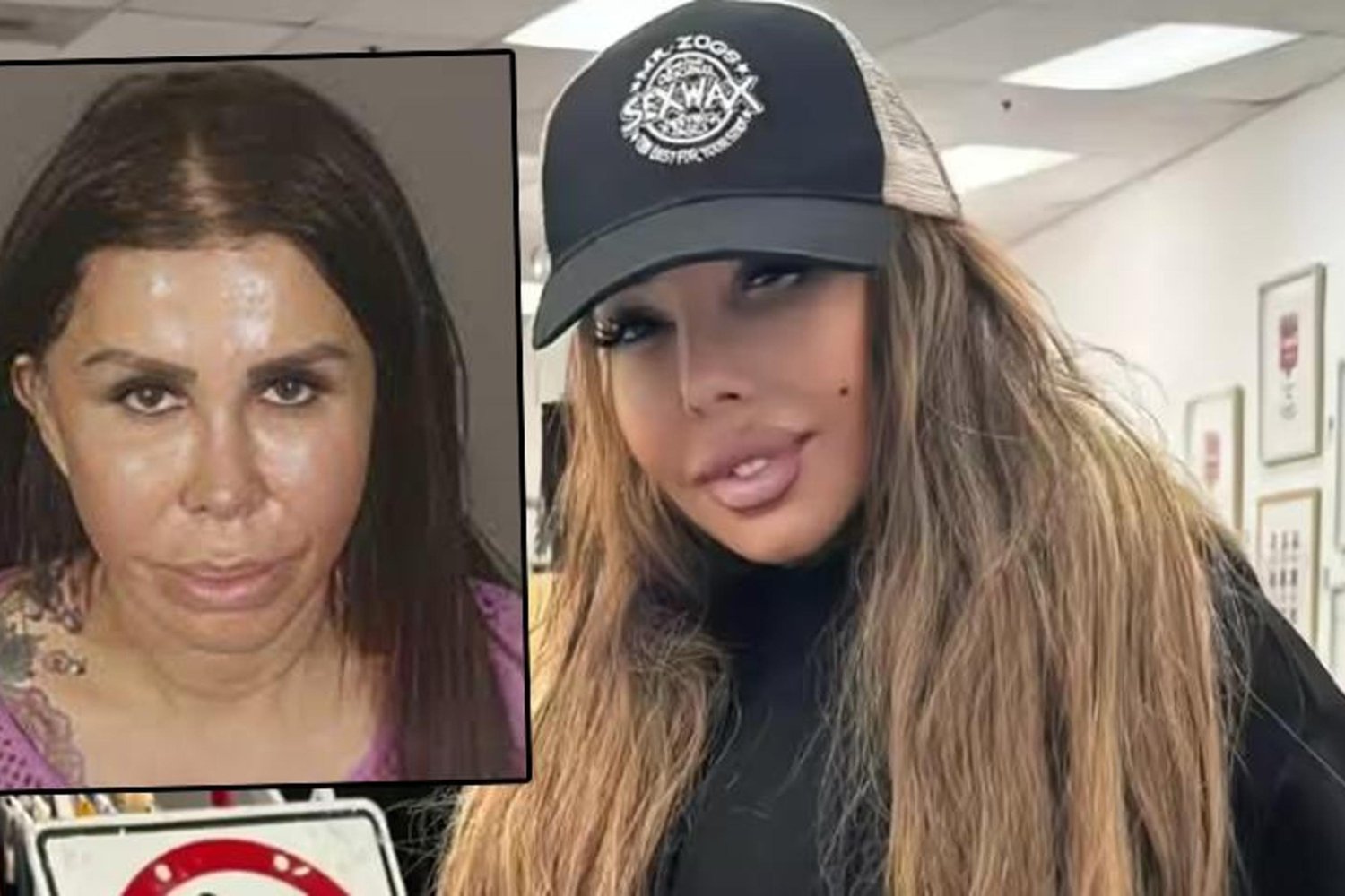 Kadın Silikon Enjeksiyonu Cinayetiyle Hapis Cezası Aldı