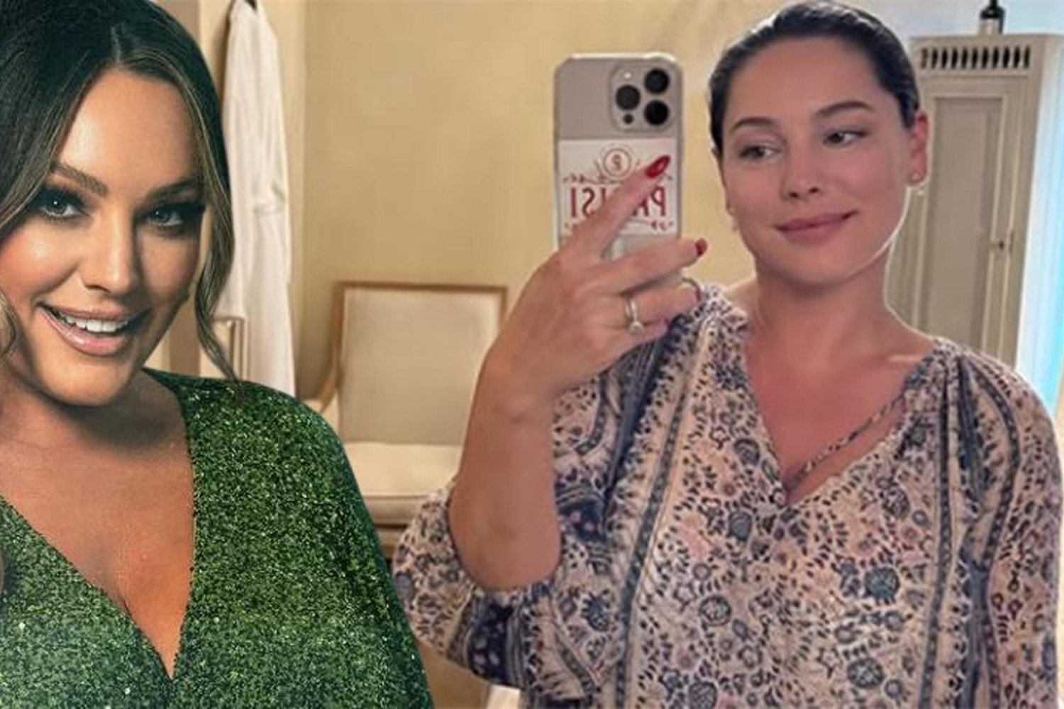 Kelly Brook'tan Estetik Güncellemesi: Yağ Enjektasyonu Reddedildi!