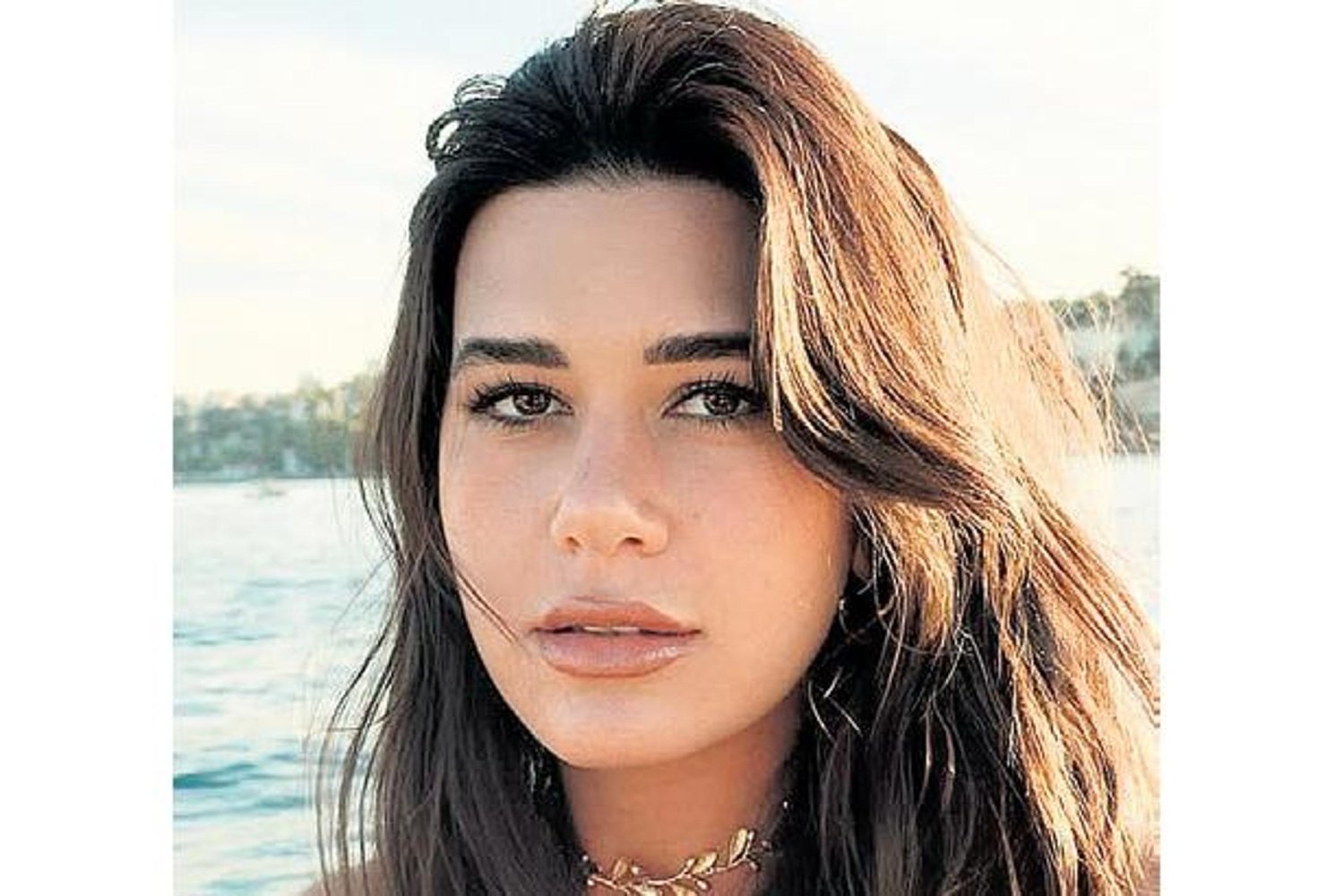 Sosyal Medya Fenomeni Ateş Durumunda İyiye Gidiş