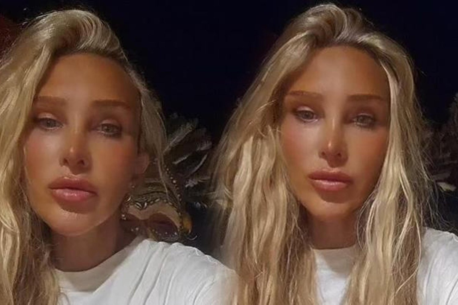 Seren Serengil'den Üzücü Haber: Annesi Yoğun Bakımda