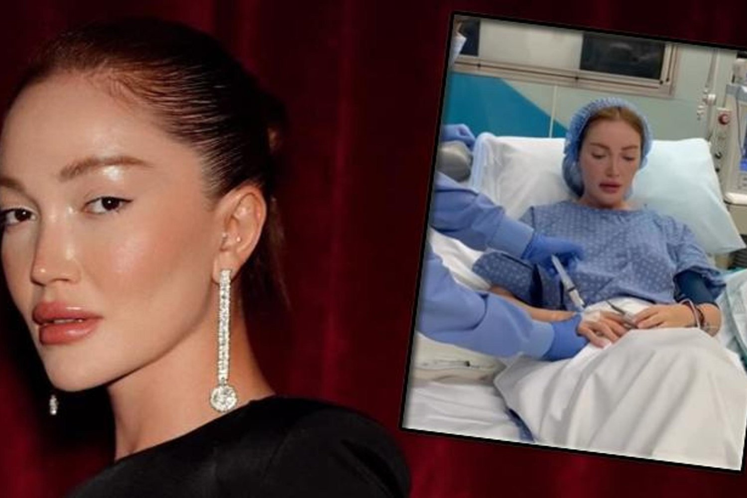 Danla Bilic Kalça Dolgusu Operasyonunu Tekrarladı: Takipçilerine Uyarı