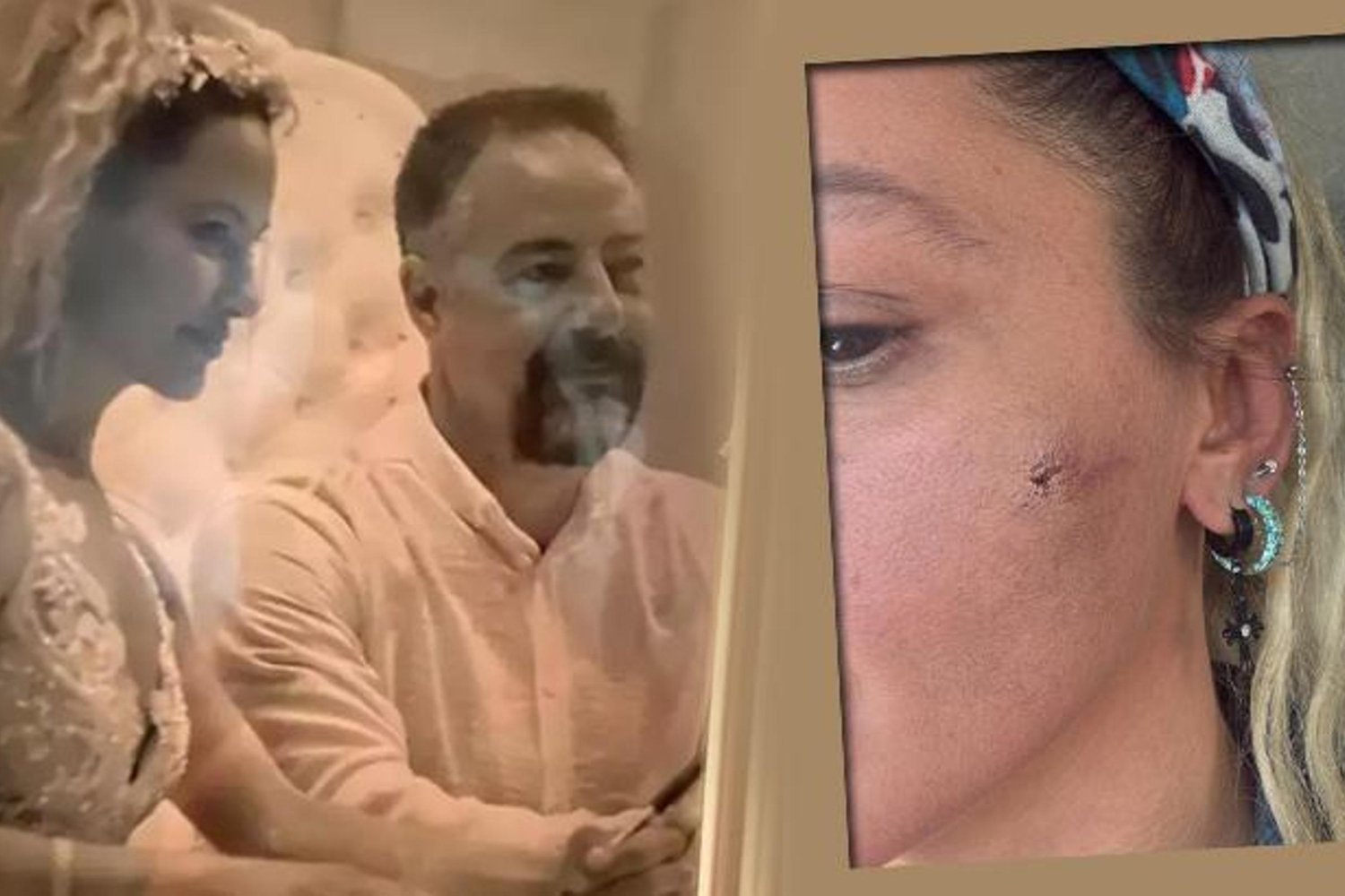 Yıldız Asyalı'dan Şok İddia: Eşinden Şiddet Gördü! En Güncel Detaylar