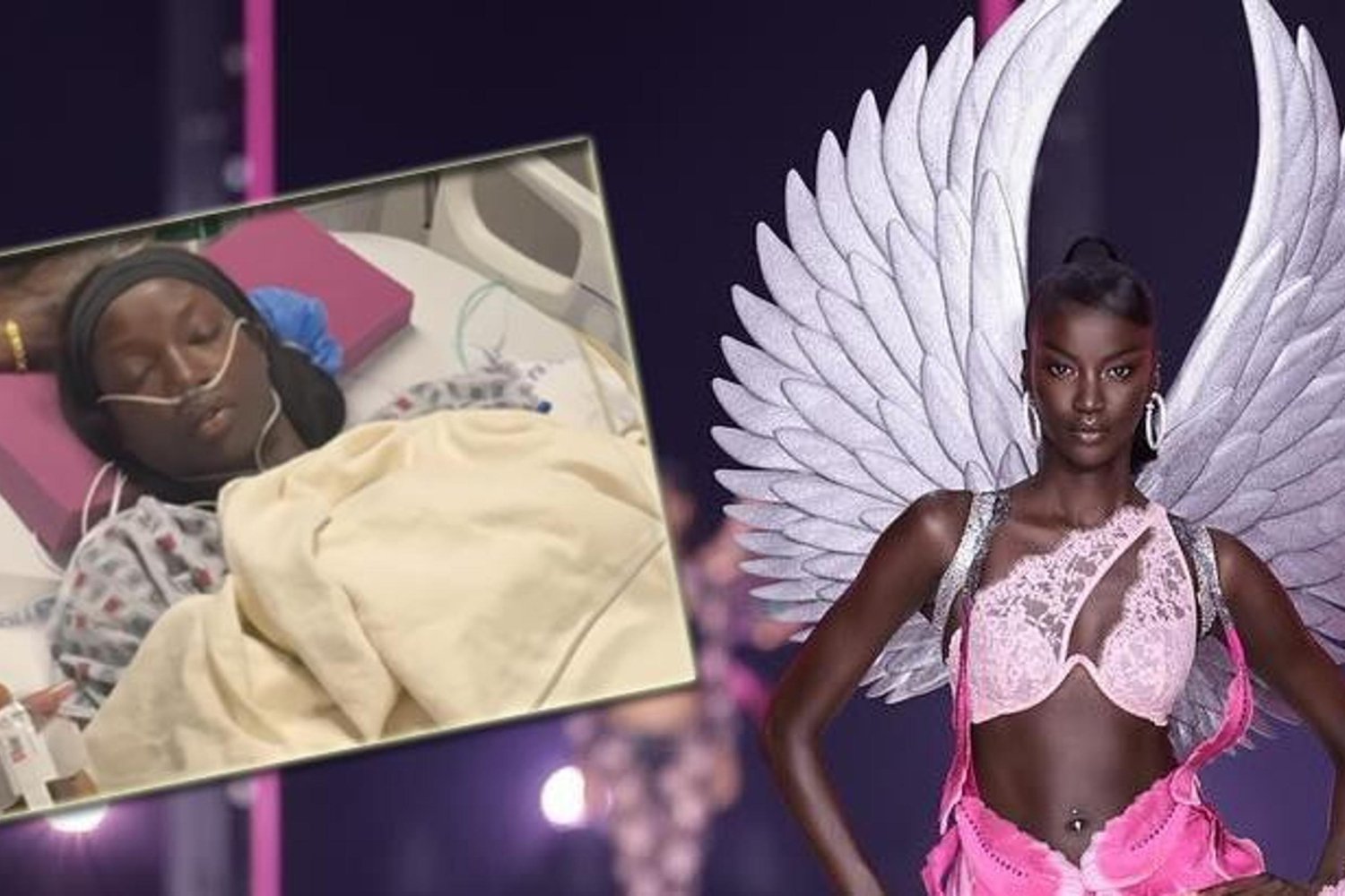 Süpermodel Anok Yai'den Şok Açıklama: Doğuştan Gelen Akciğer Sorunu Ameliyatla Çözüldü