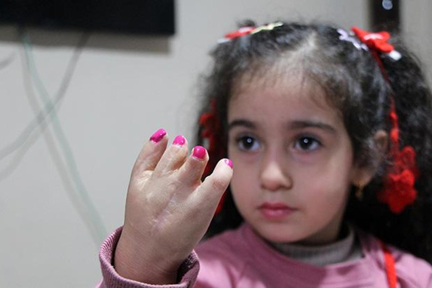 Maddi Zorluklar İçinde Mücadele Eden Elif Lina'nın Sağlık Hikayesi