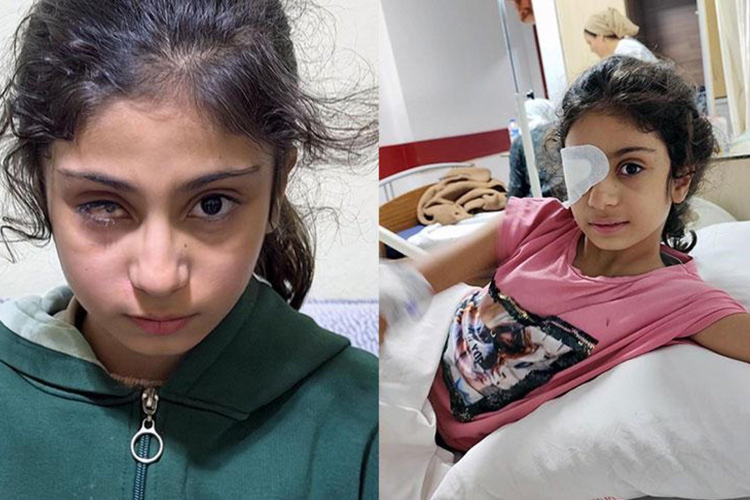 Gözlük Faciası: Çocuk Gözünü Kaybetti, Optik ve Doktor Hakkında Soru İşaretleri