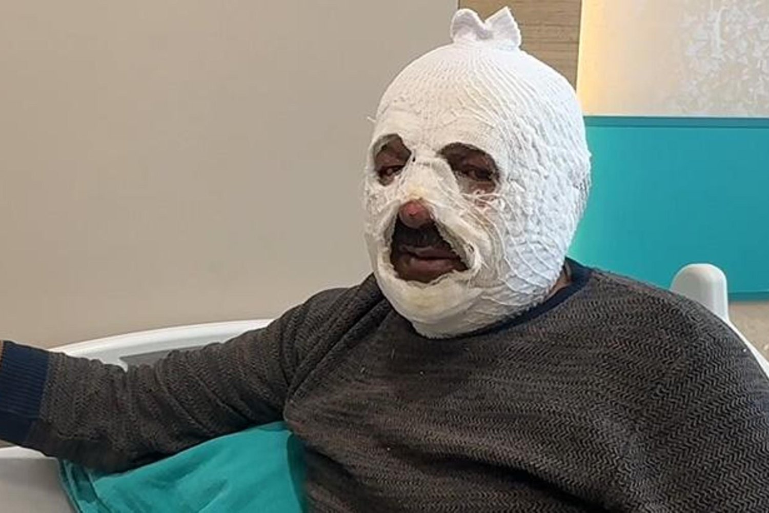 Yanıcı Maddeyle Olay Yapan İşçinin Başına Gelenler Şok Edici!