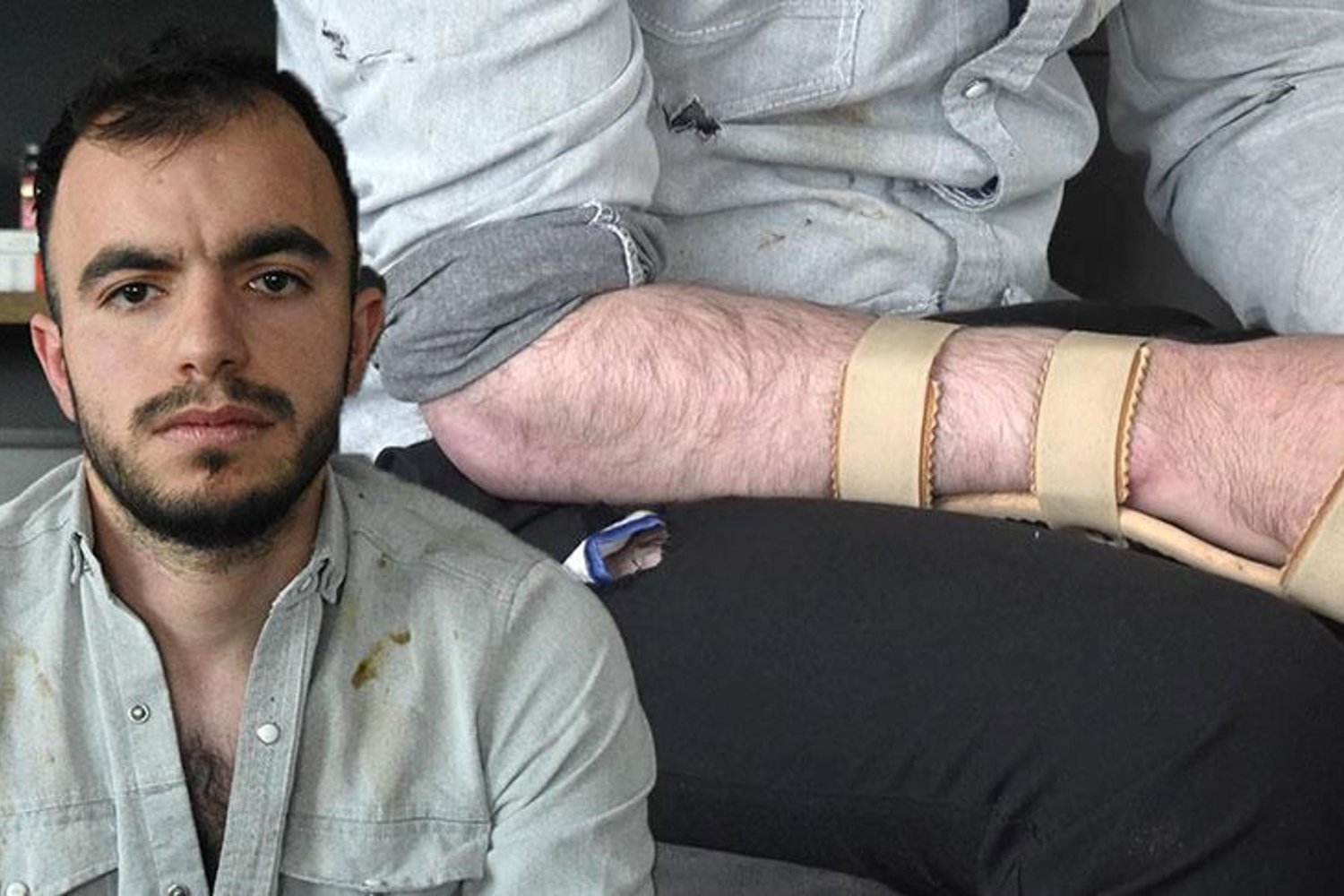 İş Kazası Sonrası Hak Arayışında Büyük Tazminat Artışı!