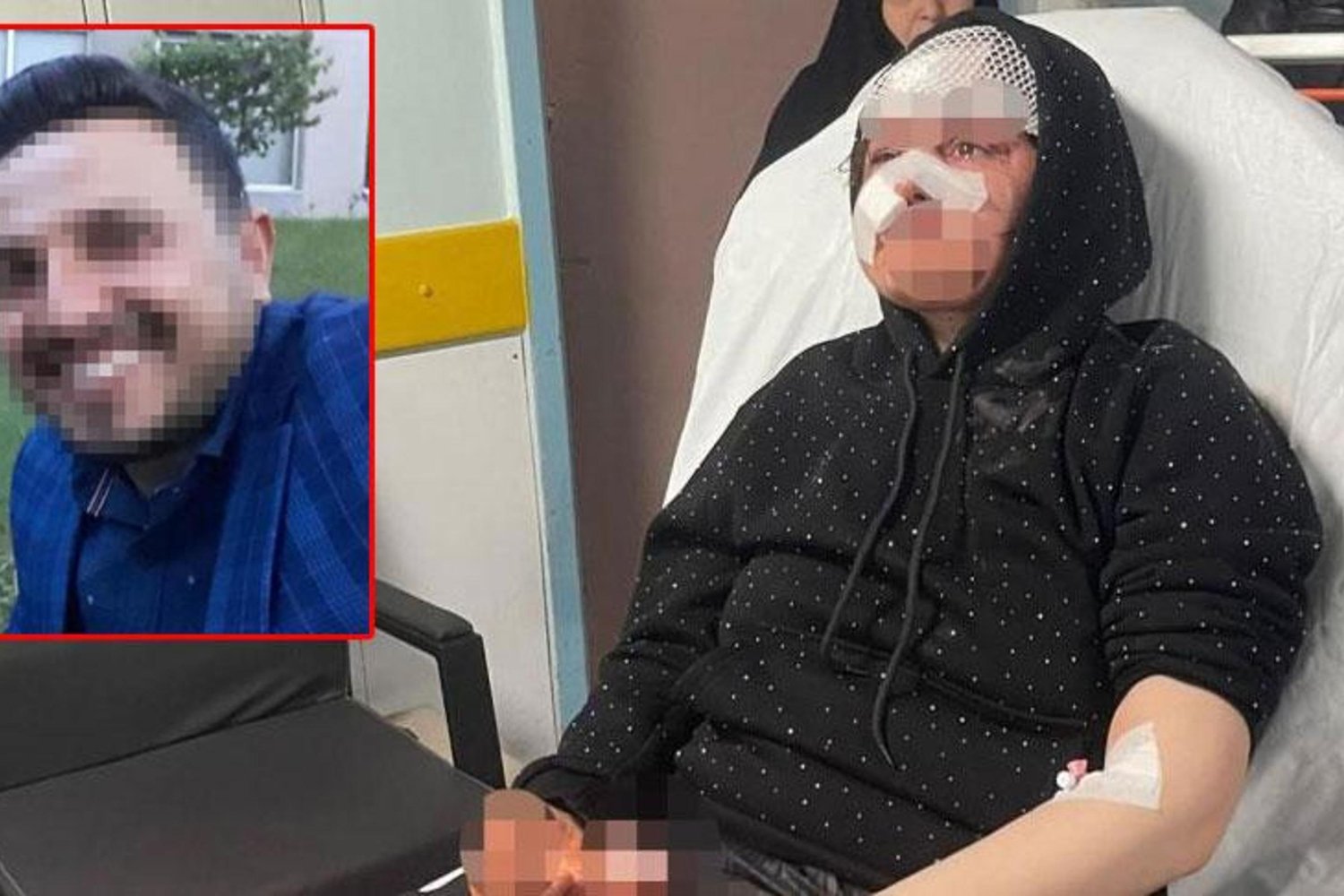 Şiddetli Boşanma Tartışması Kanlı Bitti! Gaziantep'te Kadın Darp Edildi