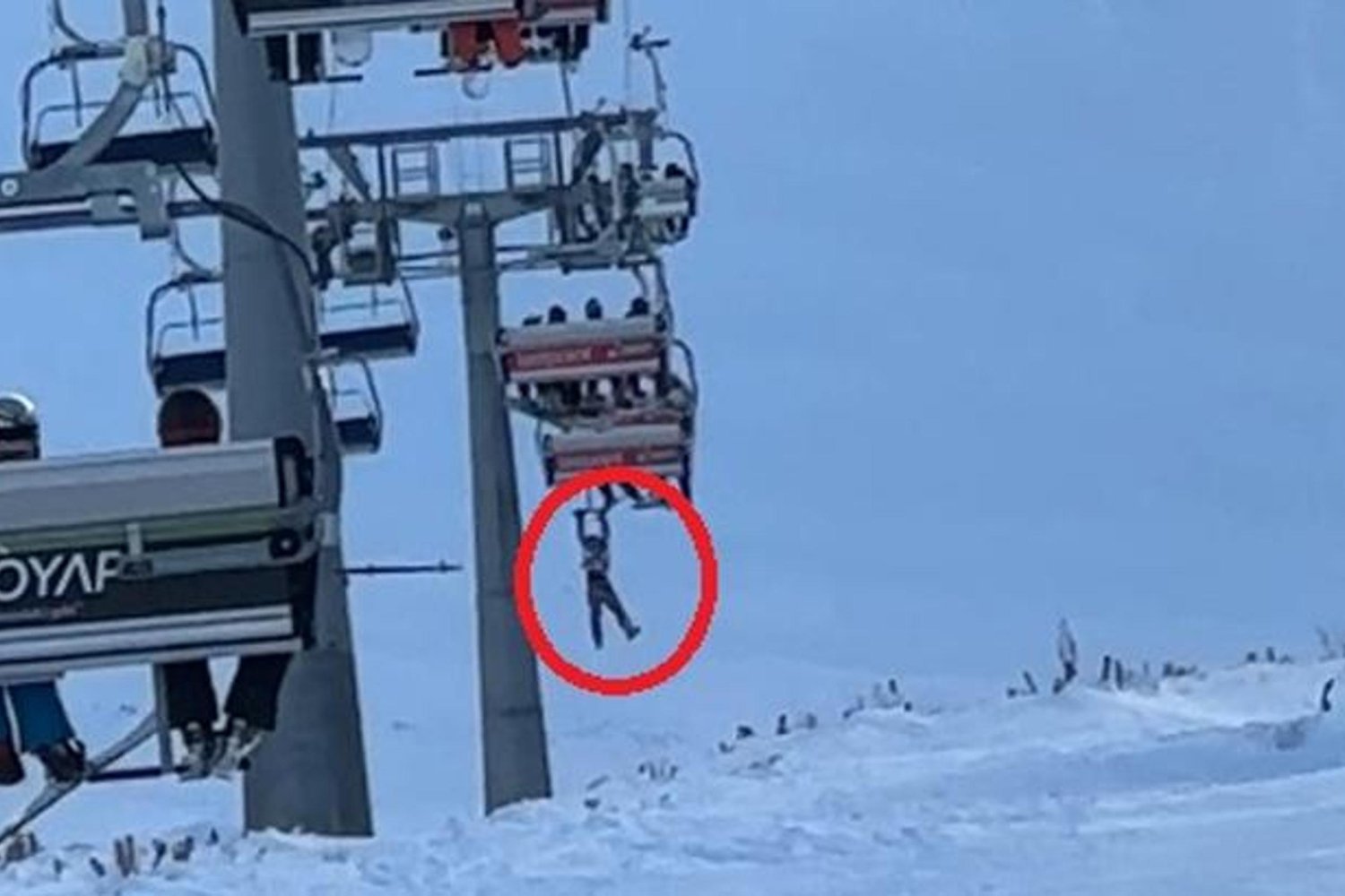 Erciyes Kayak Merkezi'nde Snowboard Düşürme Kazası Güvenlik Sıkıntısını Gün yüzüne çıkardı