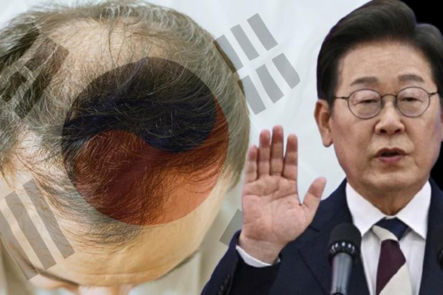 Kore’de Saç Dökülmesine Devlet Desteği Tartışması Güçleniyor