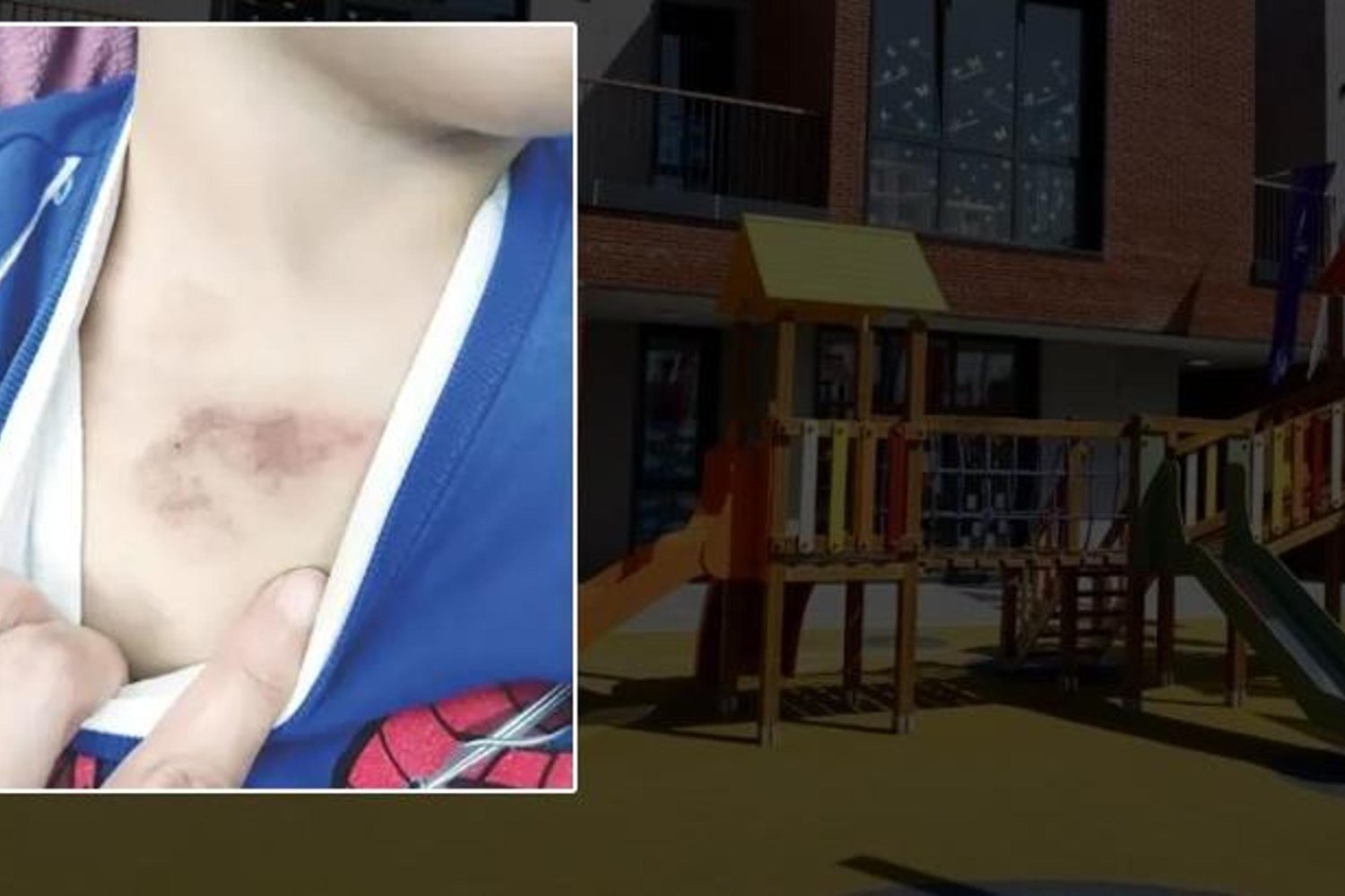 İBB'ye Bağlı Kreşte Çocuk Darp ve İstismar İddiaları Şok Etkisi Yaratıyor