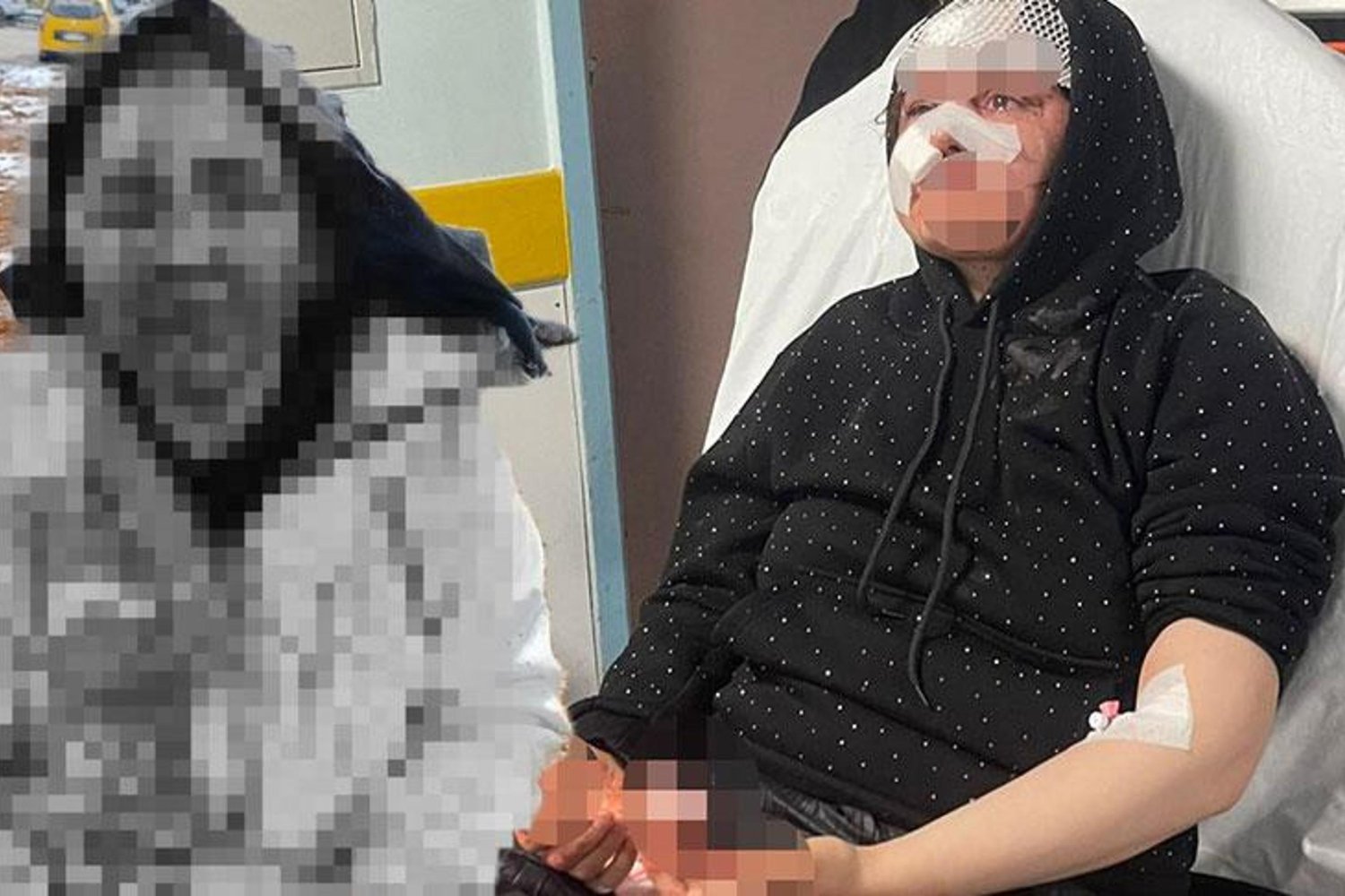 Gaziantep'te Boşanma Çekişmesi Kanlı Bitti: Kadın Şiddete Uğradı, Gözleri Gözleri Gözleri Gözleri Gözü Kırıldı