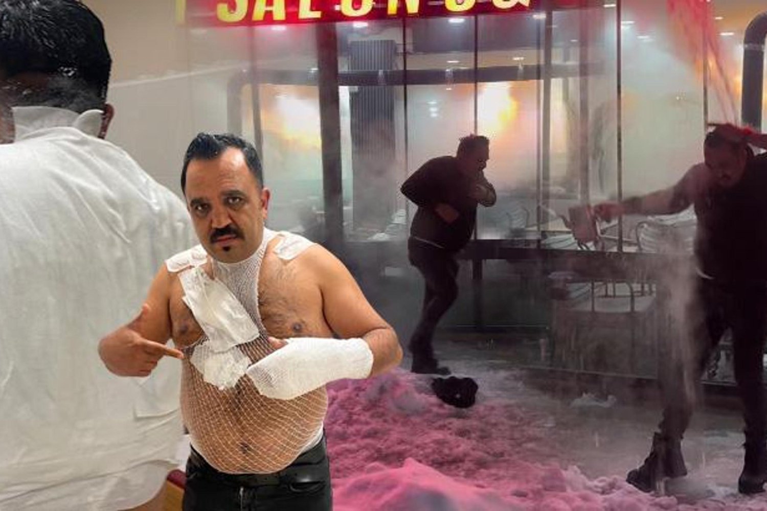 Sıcak Su Deneyi Faciası: Raşit Yıldırım Yanıklarla Hastaneye Kaldırıldı