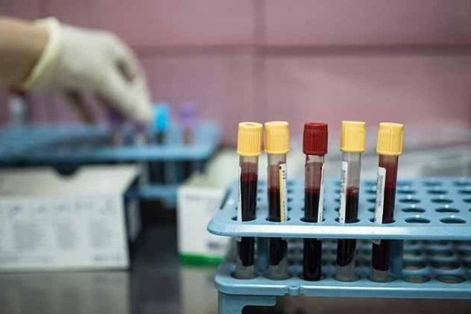 Kanseri Kendiliğinden Baskılayan Vücut Mekanizmasıyla Yeni İlaç Geliştiriliyor