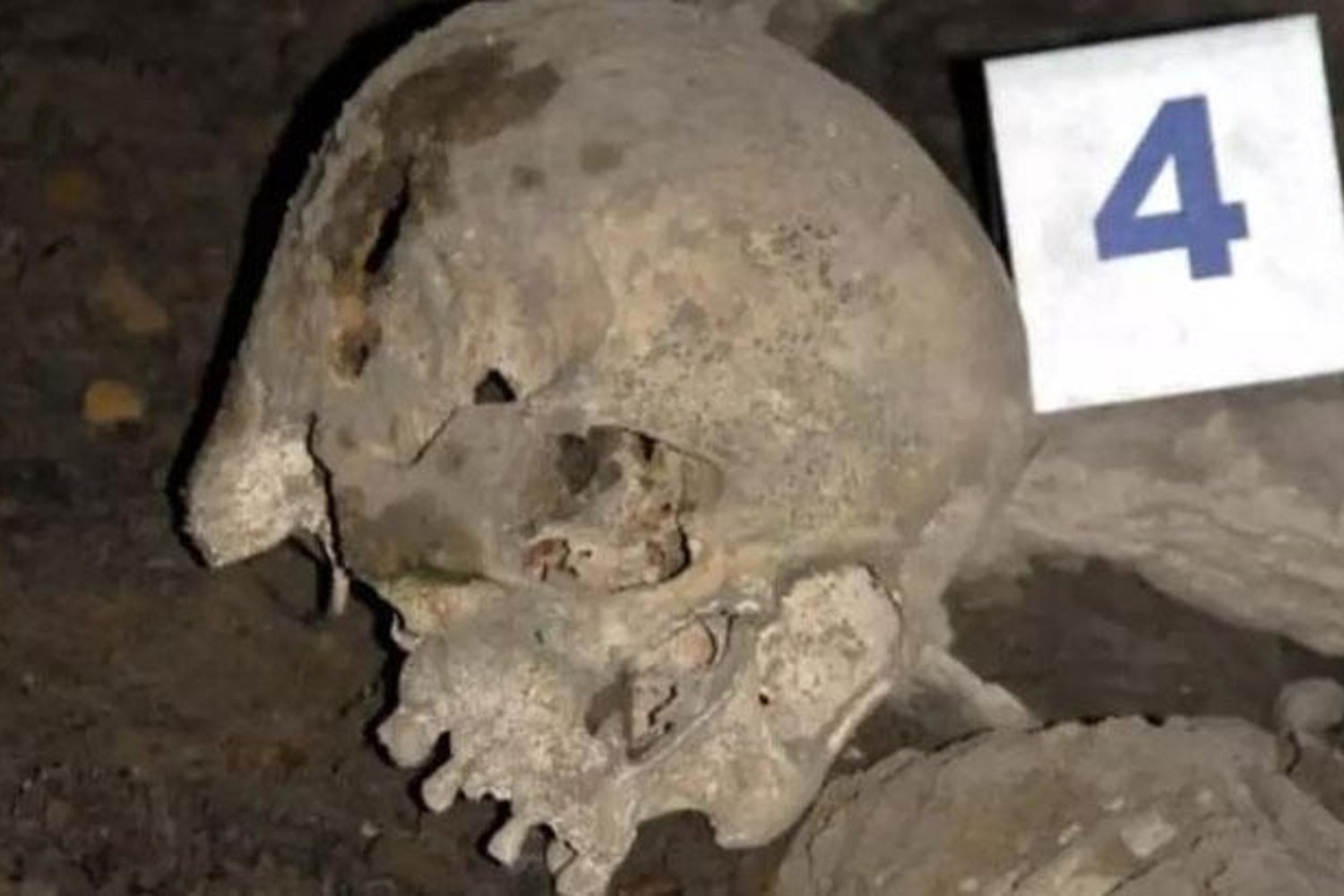 Zonguldak'ta 2010 Yılında Bulunan Kemikler Cinayeti Aydınlatıyor