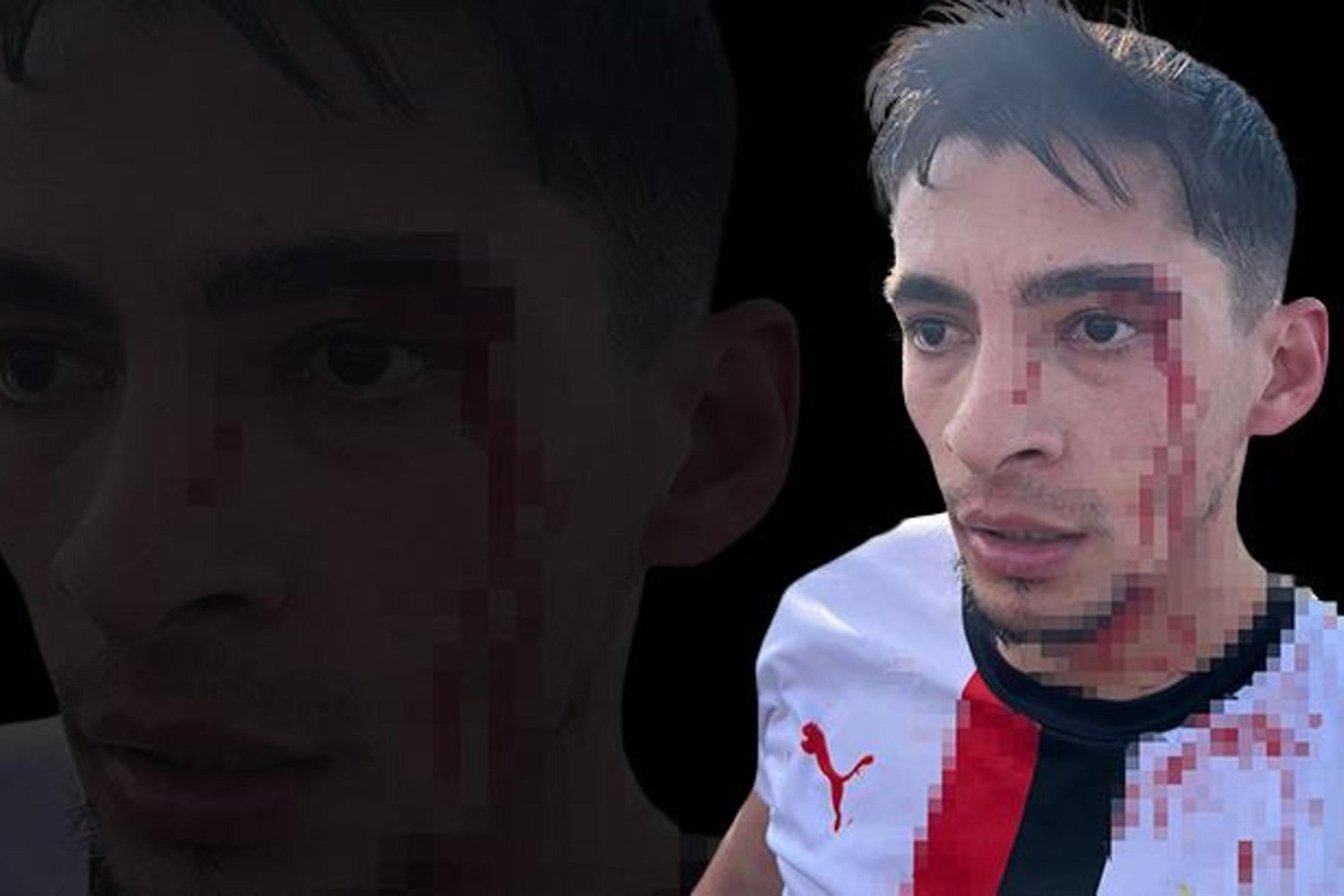 Bilecik'te Futbol Maçında Şiddet ve Kavga Düzeni Kötüleştirdi: 3 Futbolcu Yaralandı!