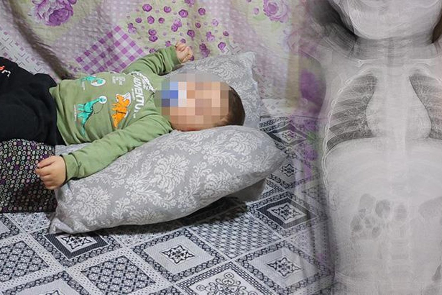 Kahramanmaraş'ta Bebek Zımba Teli Şoku: Çocuklarını Gözyaşlarıyla Anlatıyor!