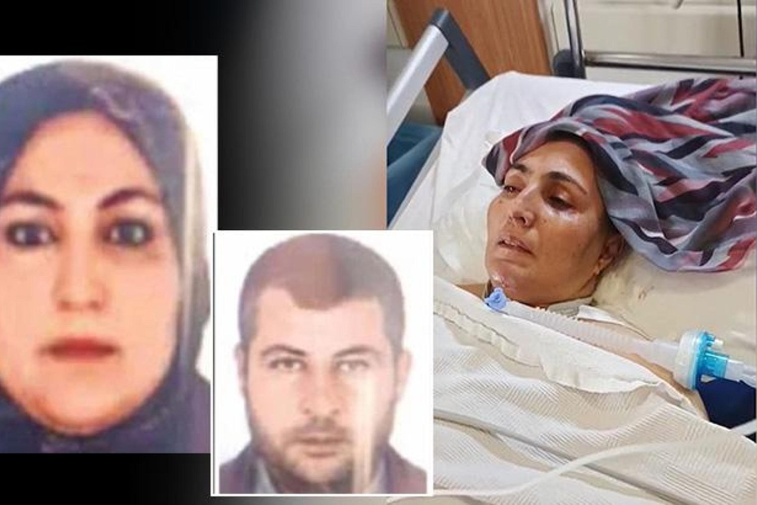 Şiddetli Darp İddiasıyla Eşi Tutuklandı: Halime Bertan Hayatta Kalma Mücadelesi Veriyor