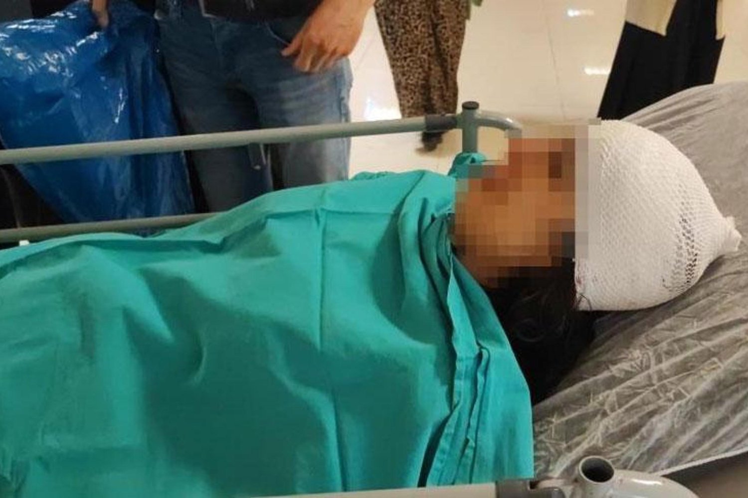 Seyhan'da Köpek Saldırısı: Kafasında 20 cm'lik Açıkla Hastaneye Kaldırıldı
