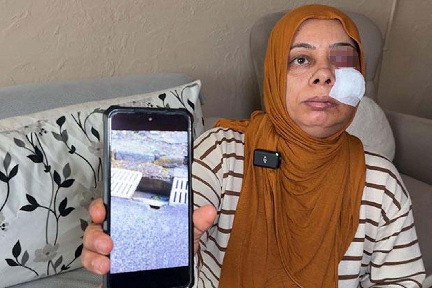 Elektrikli Bisikletli Kadın Rögara Düştü: Yüzde 14 Dikiş ve Diş Kırığıyla Ağır Yaralandı