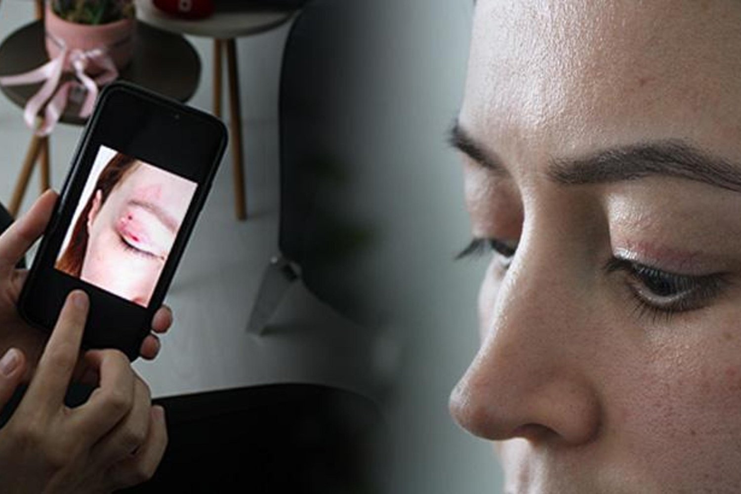 Göz Kapağı Estetiğinde Ciddi Hasar: 1100 TL'lik İşlem Riskleri ve Sonuçları