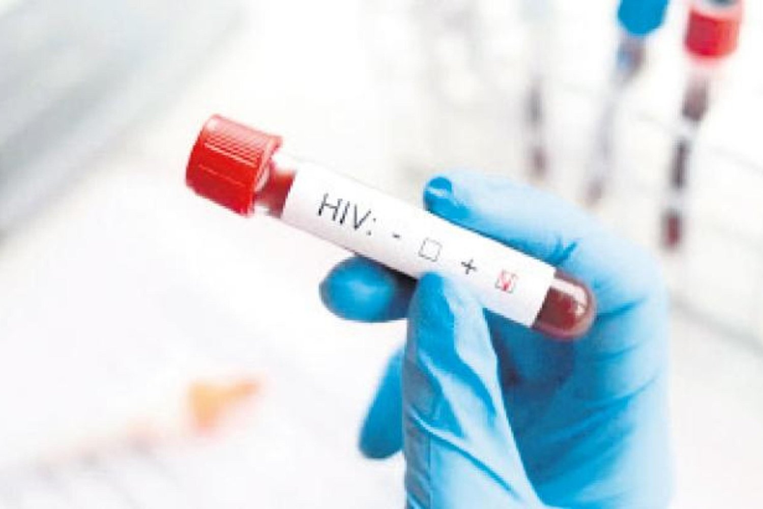 HIV Pozitif Haberleriyle Şok Olan E.K’nin Gizli Yüzü