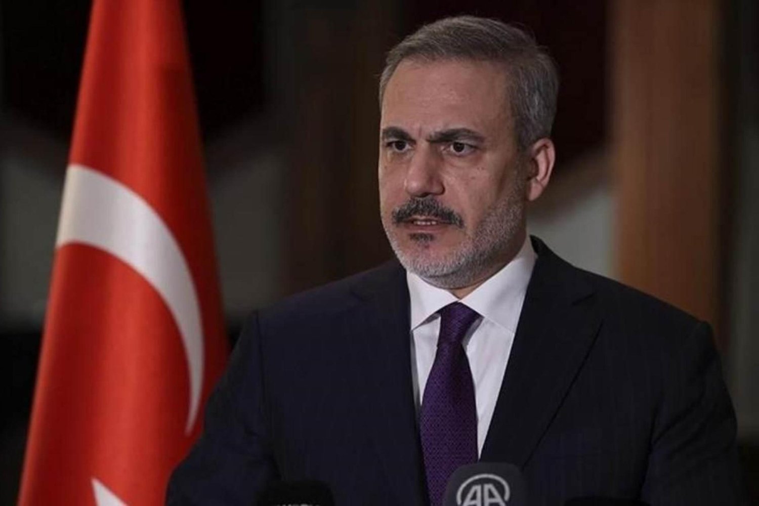 Ünlü Şarkıcı Efsun'dan Sürpriz Göz Altı Bakımı İtirafı