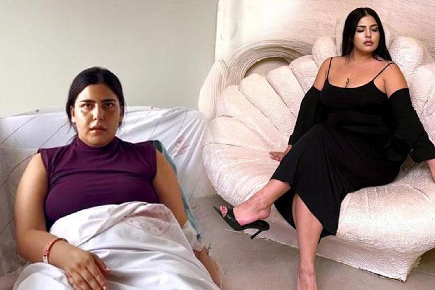 Lazer Epilasyon Sonrası Yanık Olayı Bursa'da Şok Etkisi Yarattı