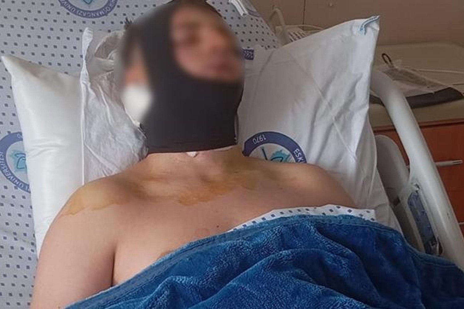 Eskişehir'de Okul Kavgasında Omurilik Kırığı: 4 Şüpheli Tutuklandı