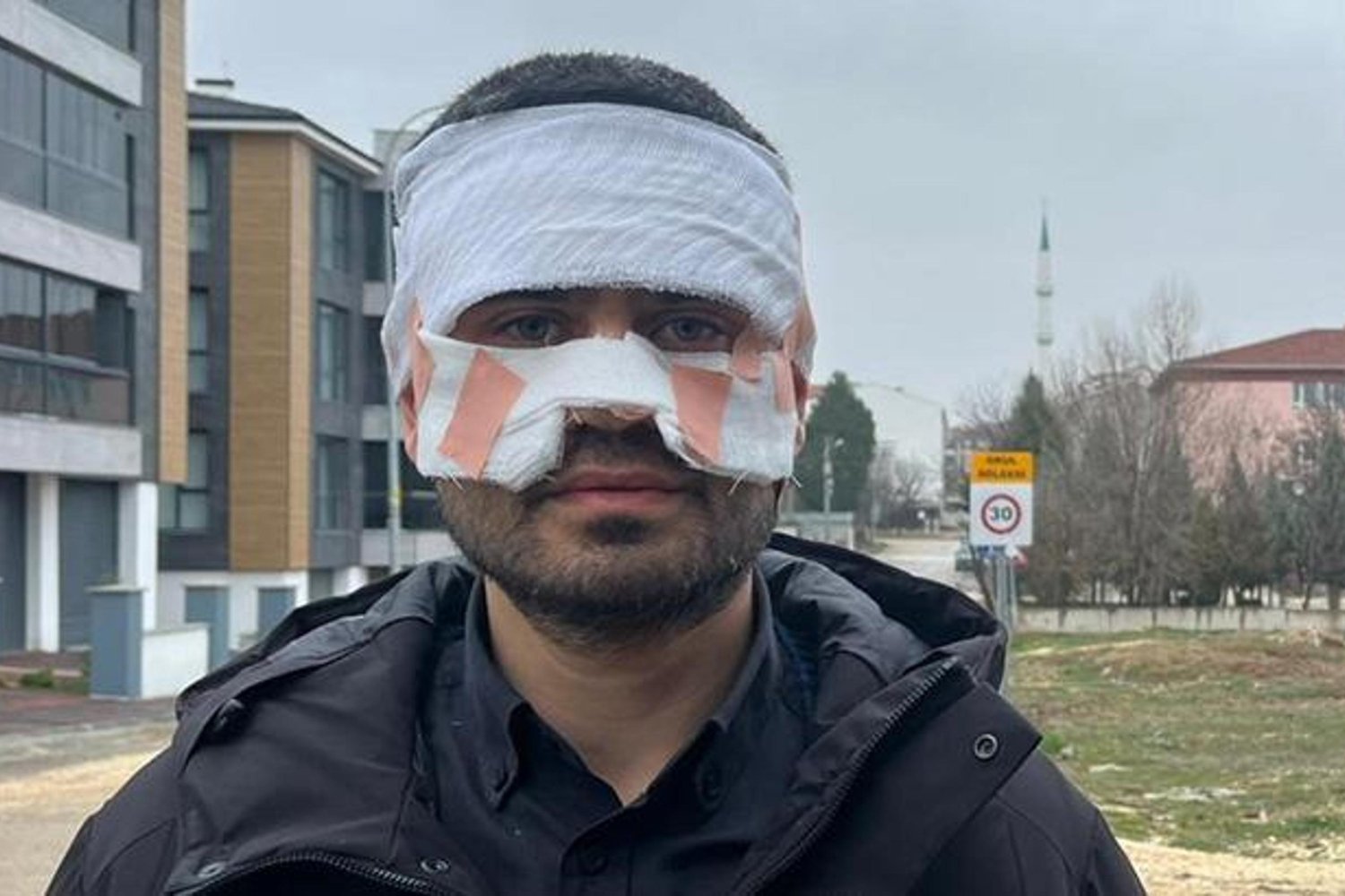 Okulda Şok Olay: Sıcak Çay Fırlatması ve Yanıklar!