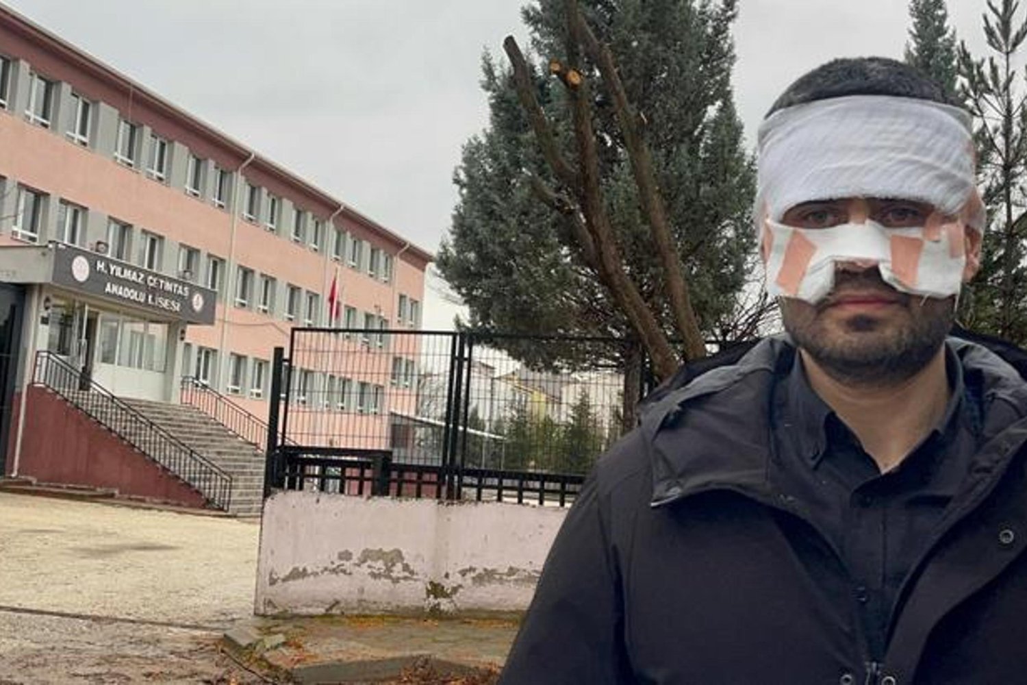 Yılmaz Çetintaş Anadolu Lisesinde Şiddetli Olay! Öğretmen Yüzü Yandı, Soruşturma Başladı