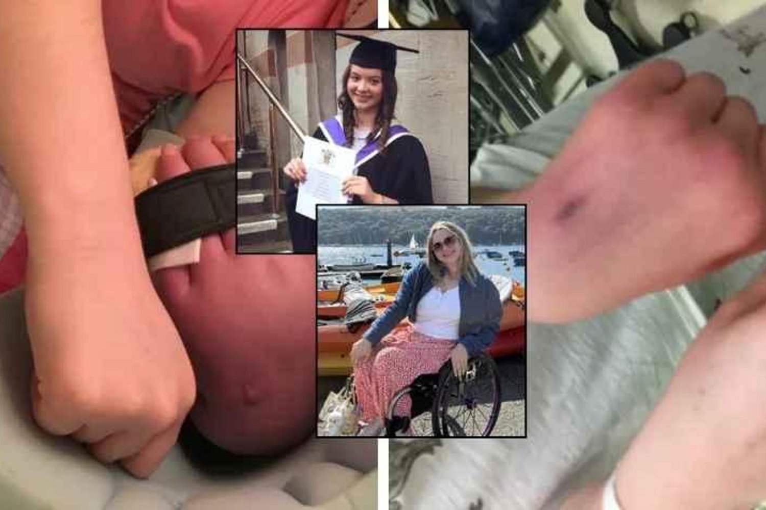 Sağlık Mücadelesiyle İlham Veren Amy Pohl: CRPS Hastalığı ve Yaşam Dersi