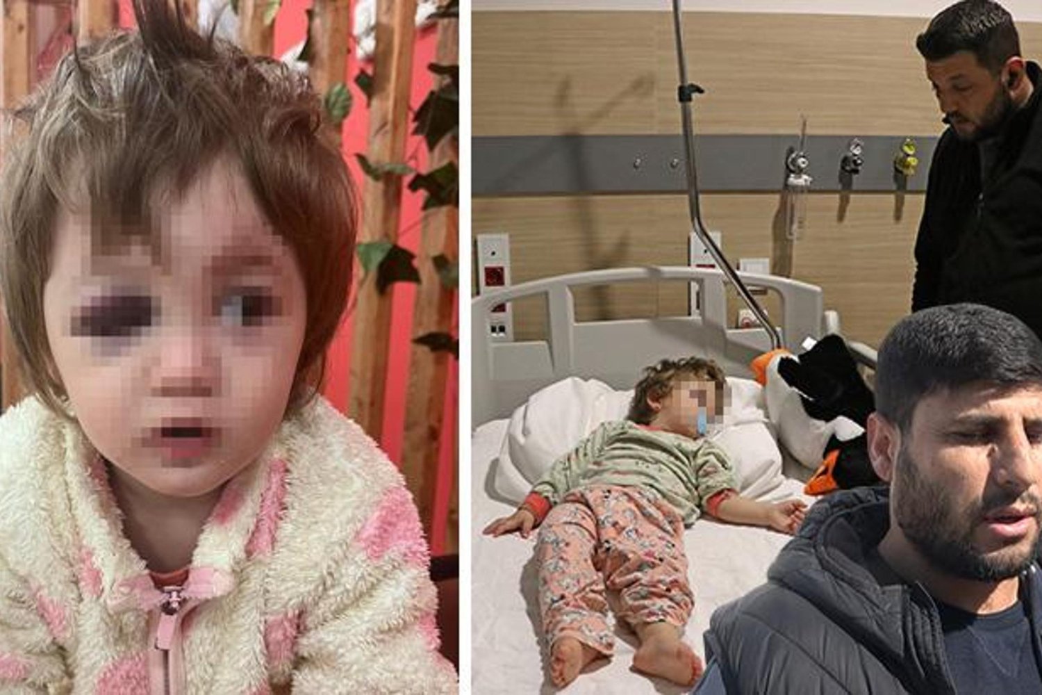 Yalova'da Aileler Arasında Şiddet: 14 Aylık Bebek ve Baba Yaralandı