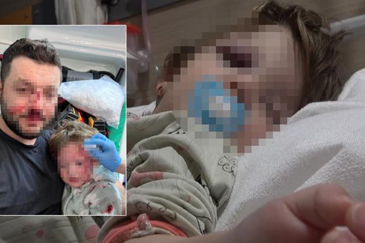 Yürekleri Dağıtan Olay: 14 Aylık Bebek İkra'nın Kafatası Çatladı! Çocuk Kavgasında Kanlı Olay