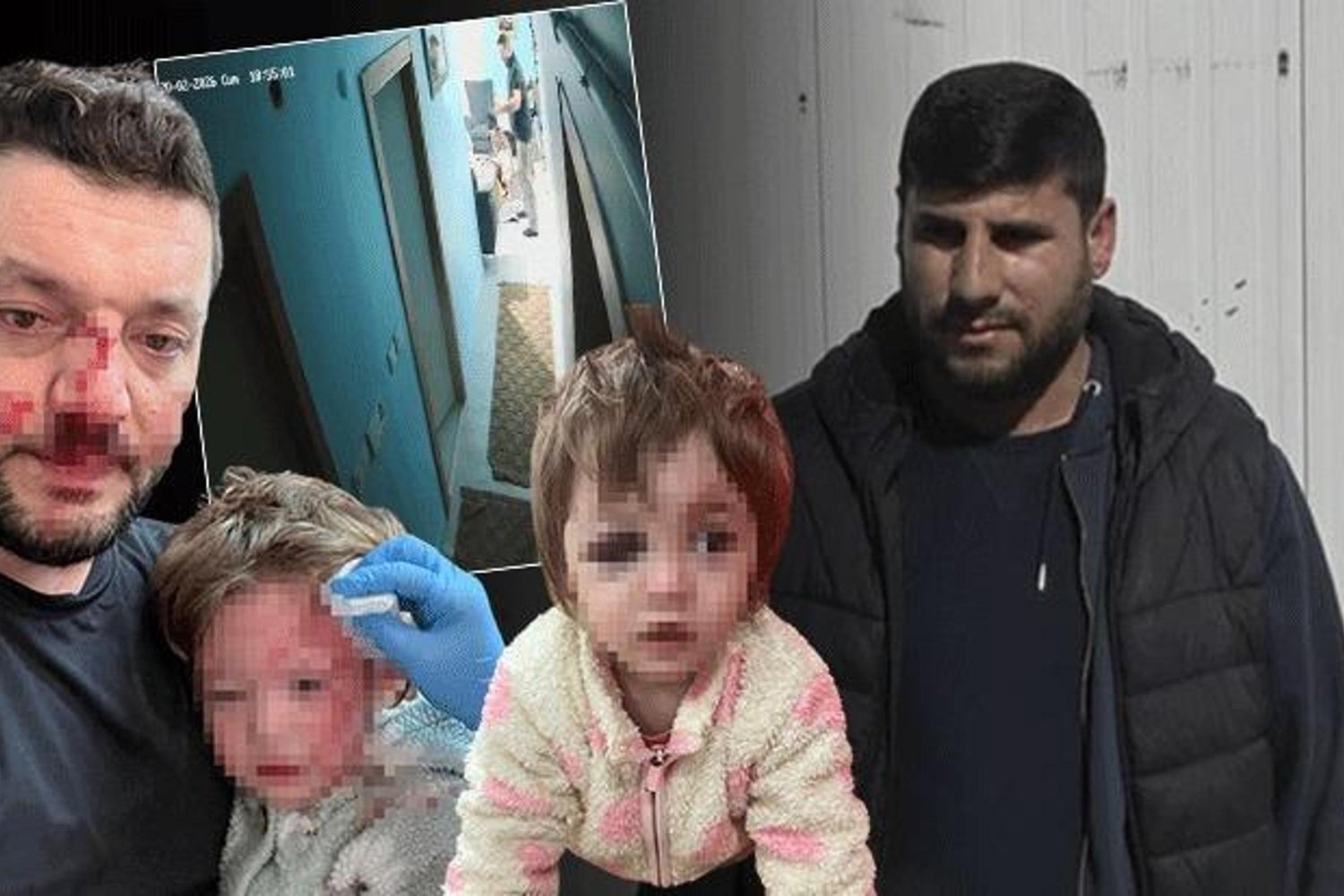 Yalova’da Aile Kavgası Kanlı Bitti: 14 Aylık Bebek ve Baba Yaralandı