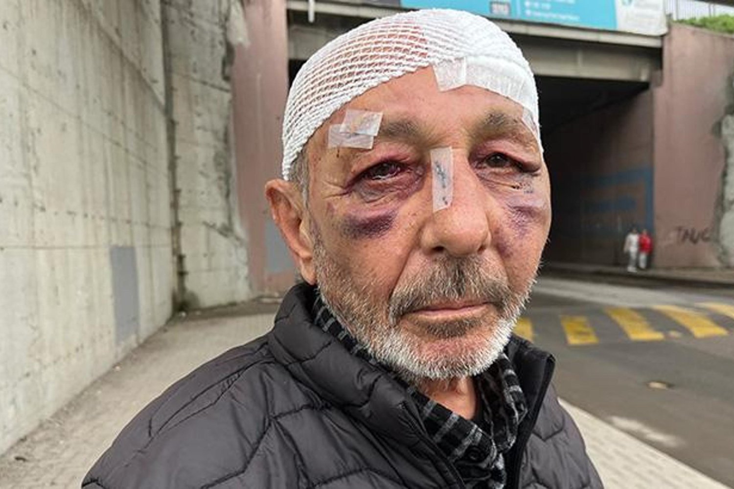 İzmit'te Saldırı Güvenlik Kameralarına Yansıdı: Darbedilen Adam Şikayetçi