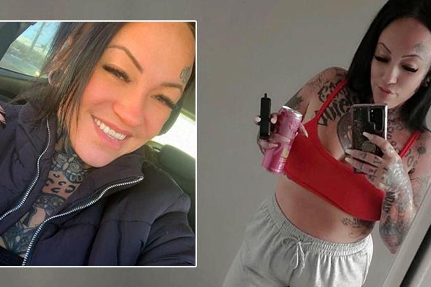 Antalya'da Estetik Ameliyatı Sonrası Ardında Ölüm Geride Bıraktı